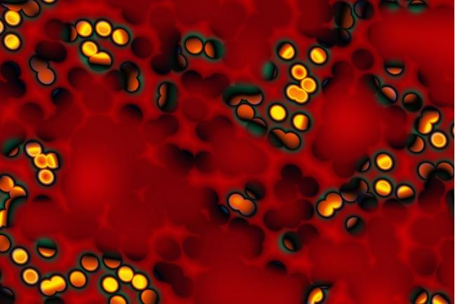 A selected image which represents the Developing a clinical registry and outcomes system for hepatitis C item